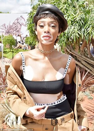 Winnie Harlow More Nude Photos