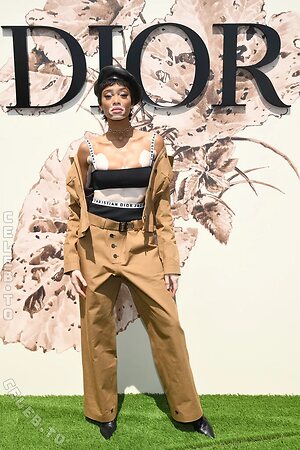 Winnie Harlow Nude Photos