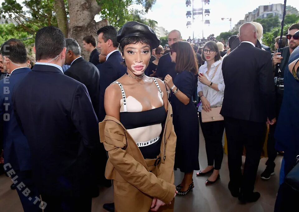Winnie Harlow Nude Leaked Photos